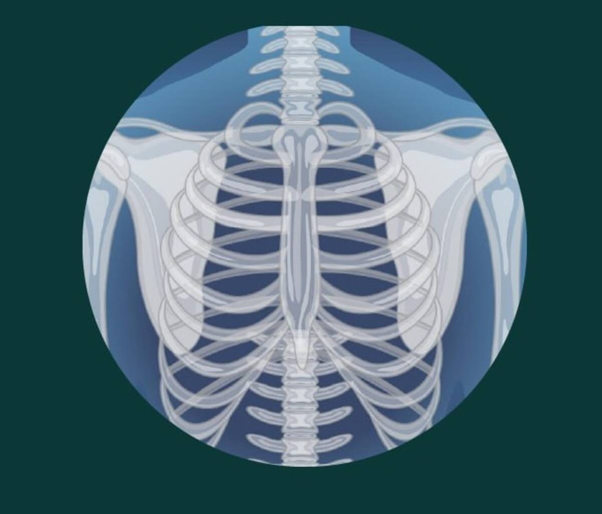 Искусственный интеллект стал помощником брянских врачей-рентгенологов